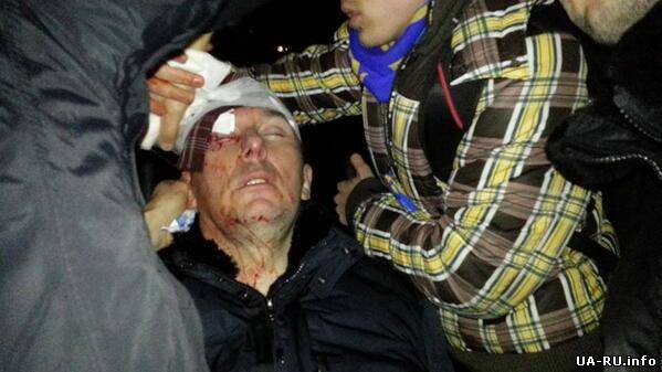 В ходе столкновений на пр Победы пострадали ориентировочно 18 человек