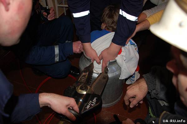 В Николаеве спасатели освобождали ребенка, который застрял в бидоне.