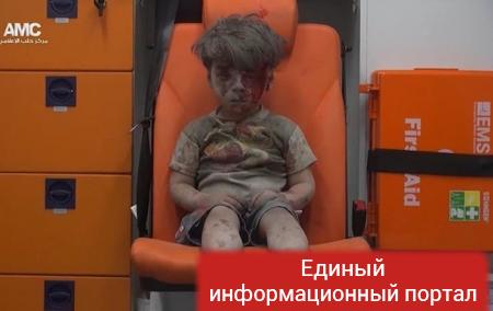 Умер брат названного "символом войны в Сирии" мальчика