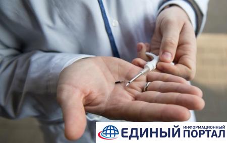 В России врач вживил себе "умные" чипы