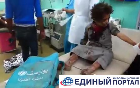 В Йемене авиация обстреляла автобус с детьми