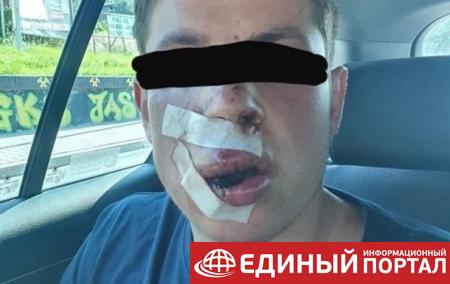 В Польше жестоко избили студента из Украины