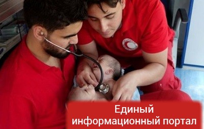 Сиамские близнецы в Сирии умерли в ожидании разрешения на операцию