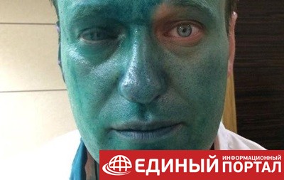 Навальный заявил, что может ослепнуть на один глаз от зеленки