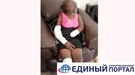 Кениец отрубил руку 16-летней девушке за отказ выйти за него замуж