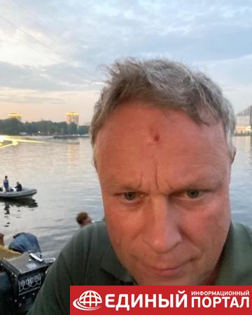 Звезда сериала Глухарь ранил в голову актера Сергея Жигунова