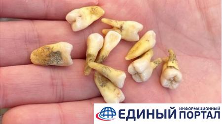 Не нашла бесплатного стоматолога: британка вырвала себе 11 зубов