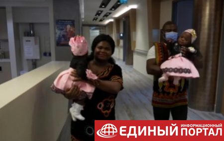 В Турции успешно разделили сиамских близнецов